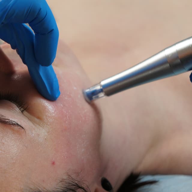 Rezenerate Nano Infusion Bundle (8) at The Facial Apothecary in Metuchen, NJ